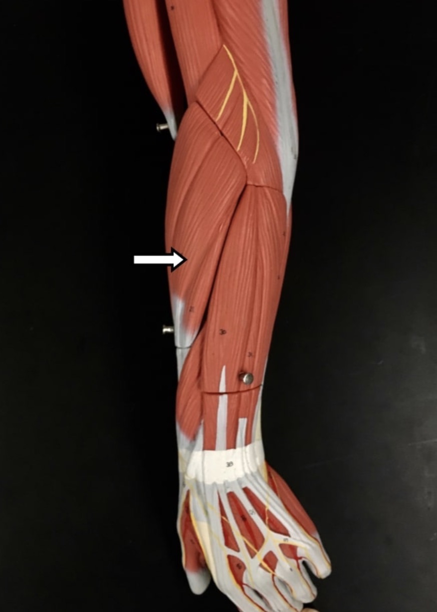 <p><span>Name the muscle labeled with the white arrow below AND name the insertion</span></p>