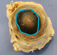 Name the structure (outermost layer)