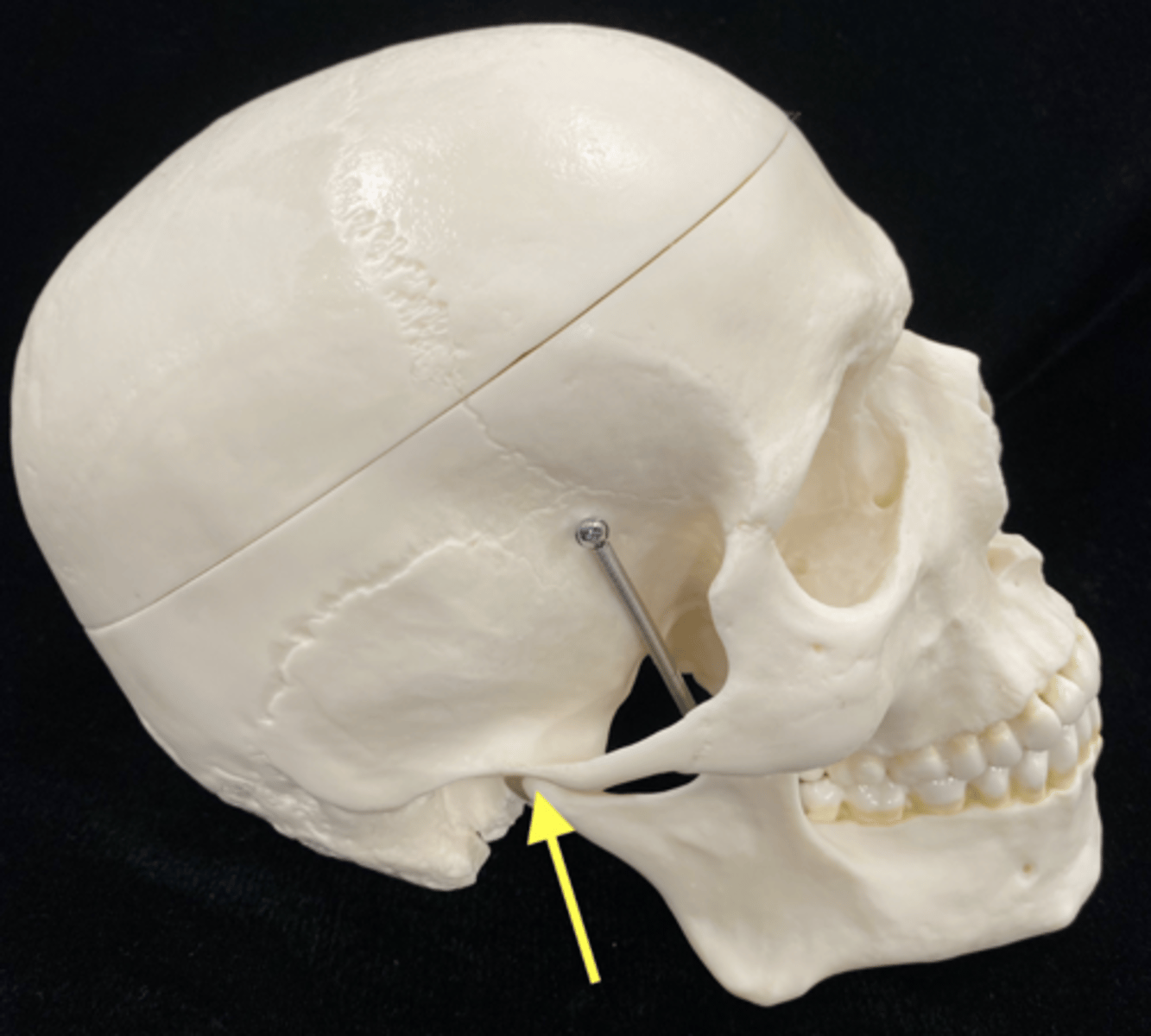 <p>name the bone and bone feature</p>