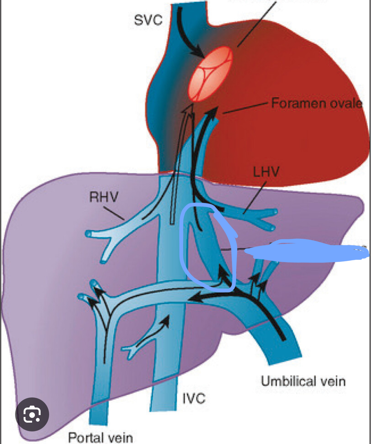 <p>Blood vessel that connects the umbilical vein to the inferior vena cava in a fetus</p>