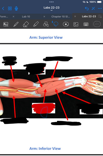 <p>What muscle is this?</p>