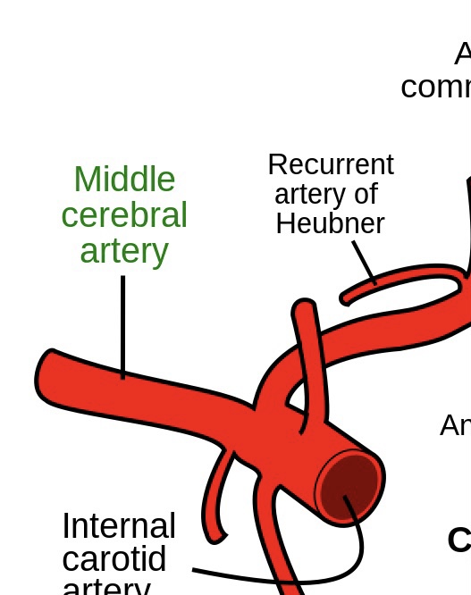 <p>Middle cerebral artery</p>