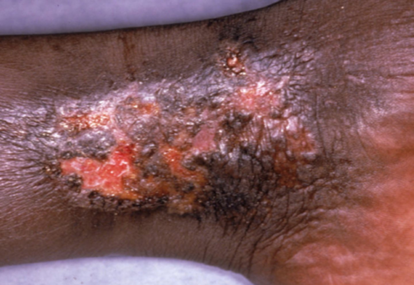 <p>What is the diagnosis?</p>