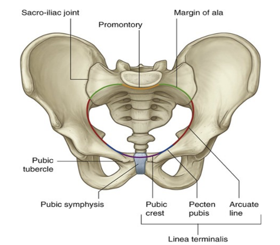 <p>The bony edge/rim surrounding &amp; thus defining the pelvic inlet is the pelvic brim — formed by —</p><ul><li><p>Promontory &amp; ala of the sacrum </p><ul><li><p>(superior surface of its lateral part, adjacent to the sacrum)</p></li></ul></li><li><p>Right &amp; left linea terminalis (terminal line) form a continuous oblique ridge together, consisting of the —</p><ul><li><p>Arcuate line on inner ilium surface</p></li><li><p>Pecten pubic (pectineal line) and pubic crest, forming the superior border of the superior ramus &amp; body of the pubis </p></li></ul></li></ul>