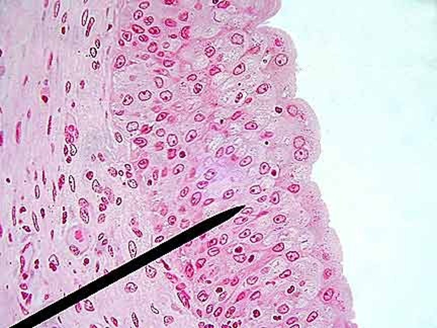 <p>Function: stretch and recoil</p><p>Location: bladder, vagina, anus ; cuboidal</p>