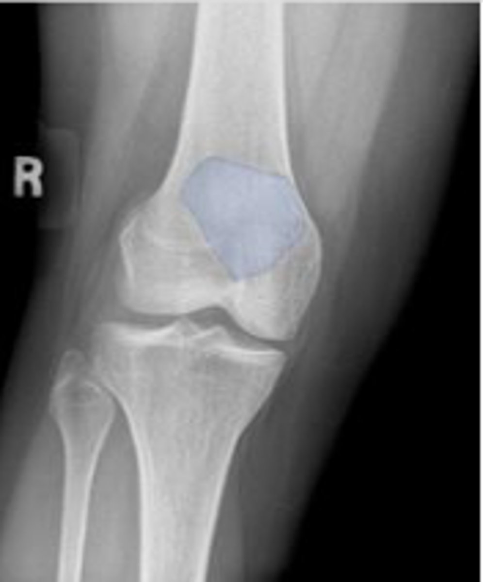 <p>What is outlined?</p>