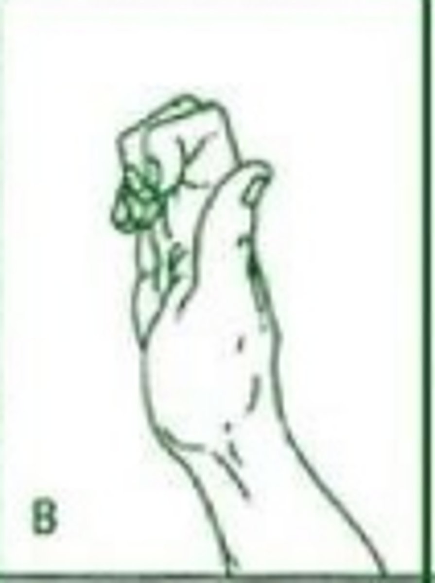 <p>MCP hyperextension and IP flexion</p>