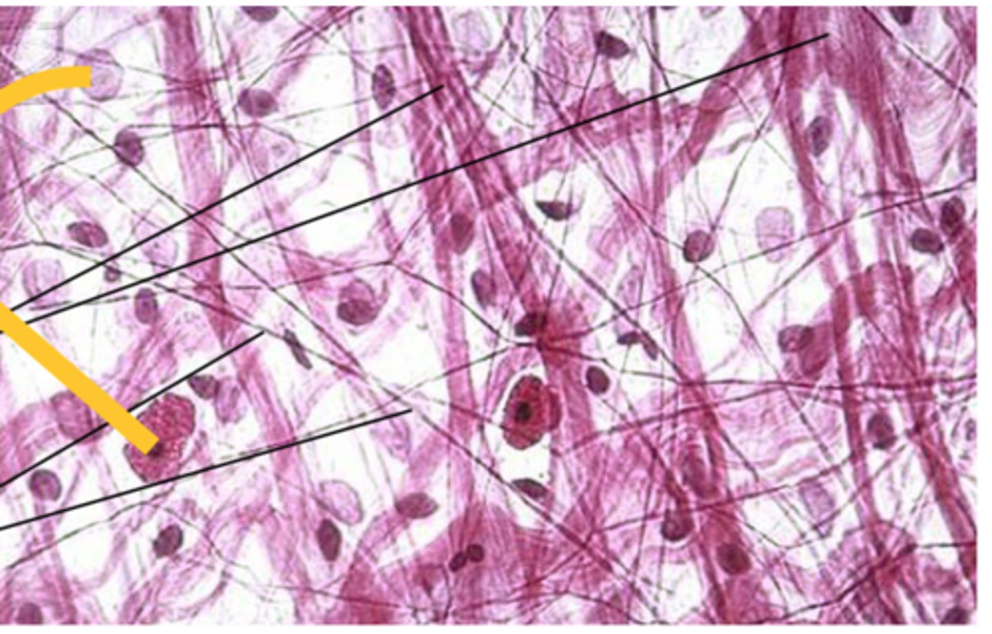 <p>responsible for the formation of fibers and aid in the production of collagen and elastin</p>