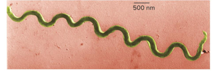 <p>Spirochaetes</p>