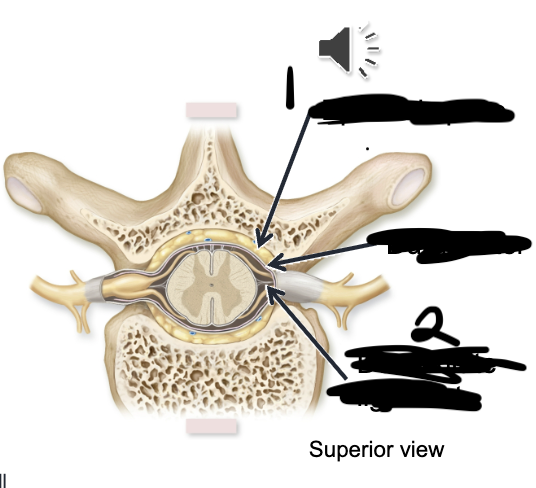 <p>Epidural/extradural space (around spinal cord only)</p>