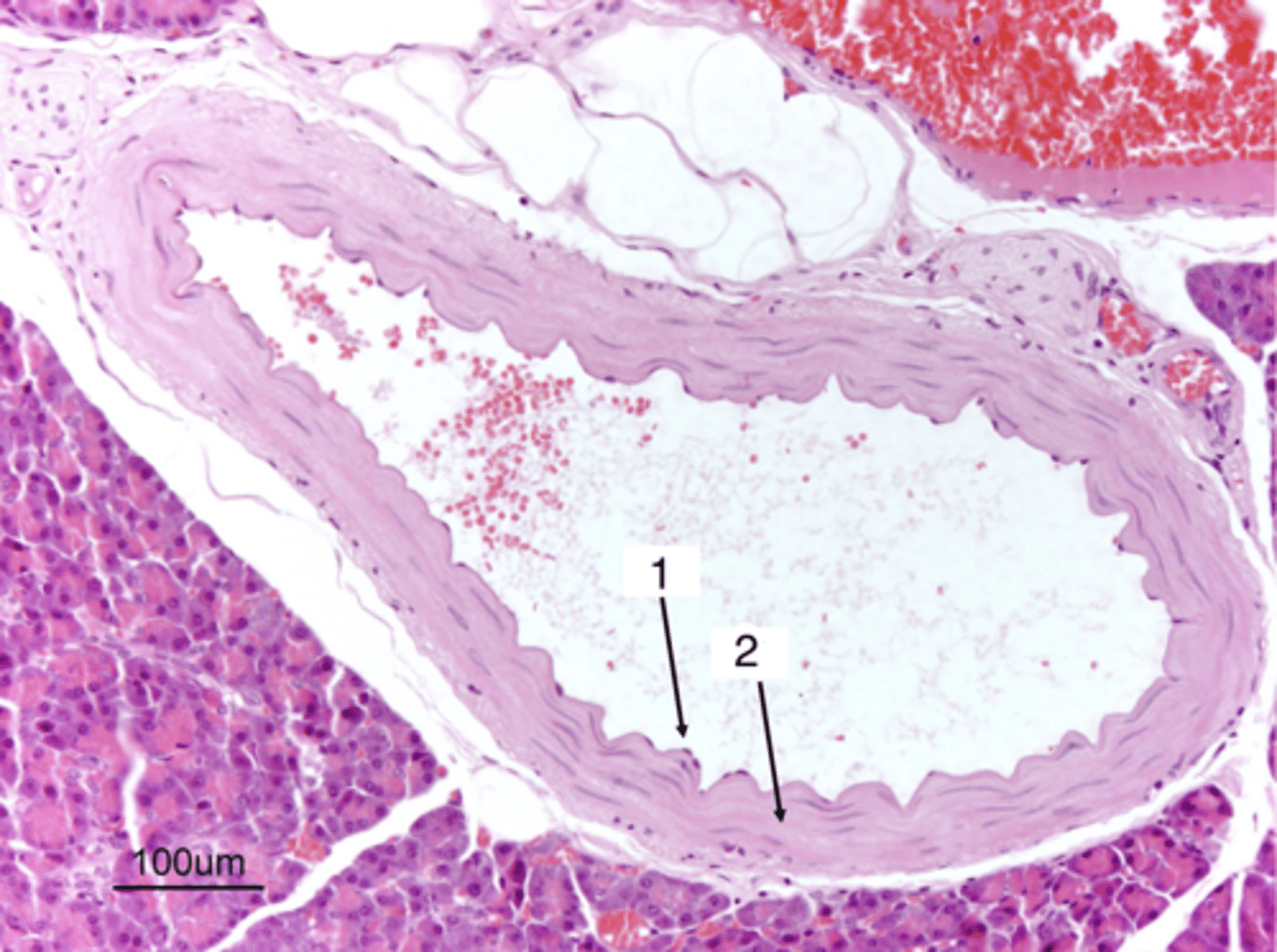 <p>what type of artery is this? why?</p>