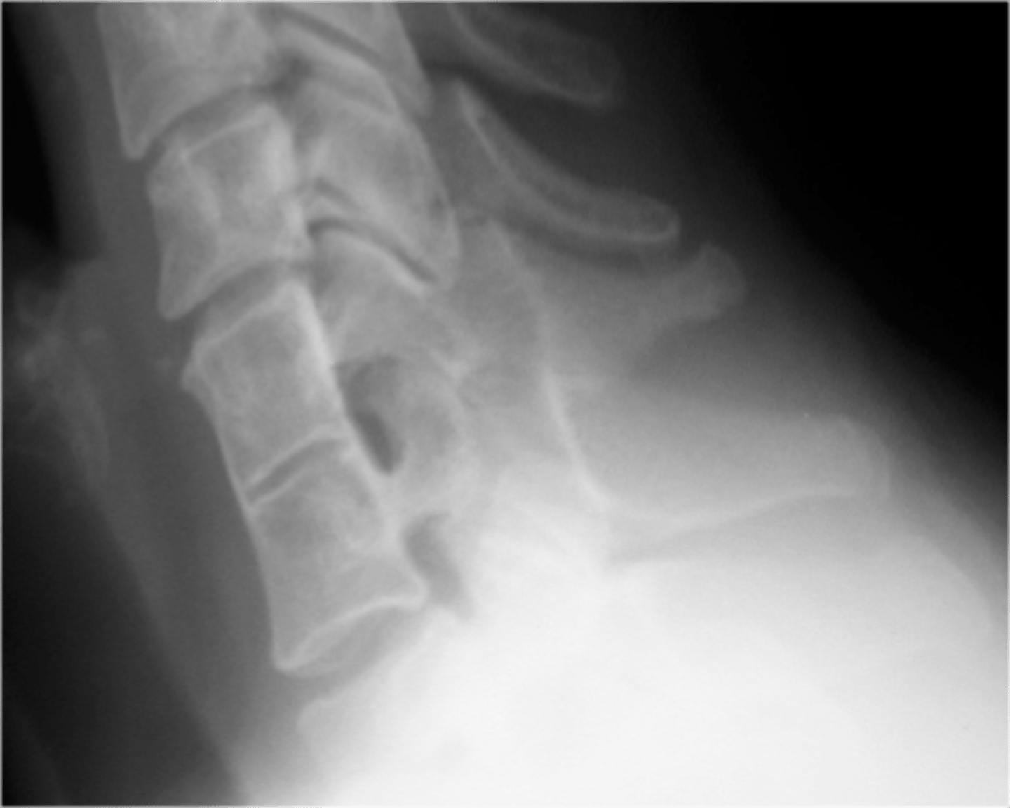 <p>Describe findings</p>