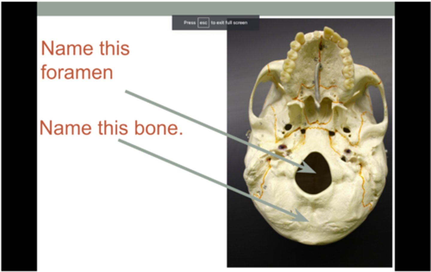 <p>opening in bone that allows passage of nerves</p><p>- e.g. foramen magnum in skull allows for passage of spinal cord</p>