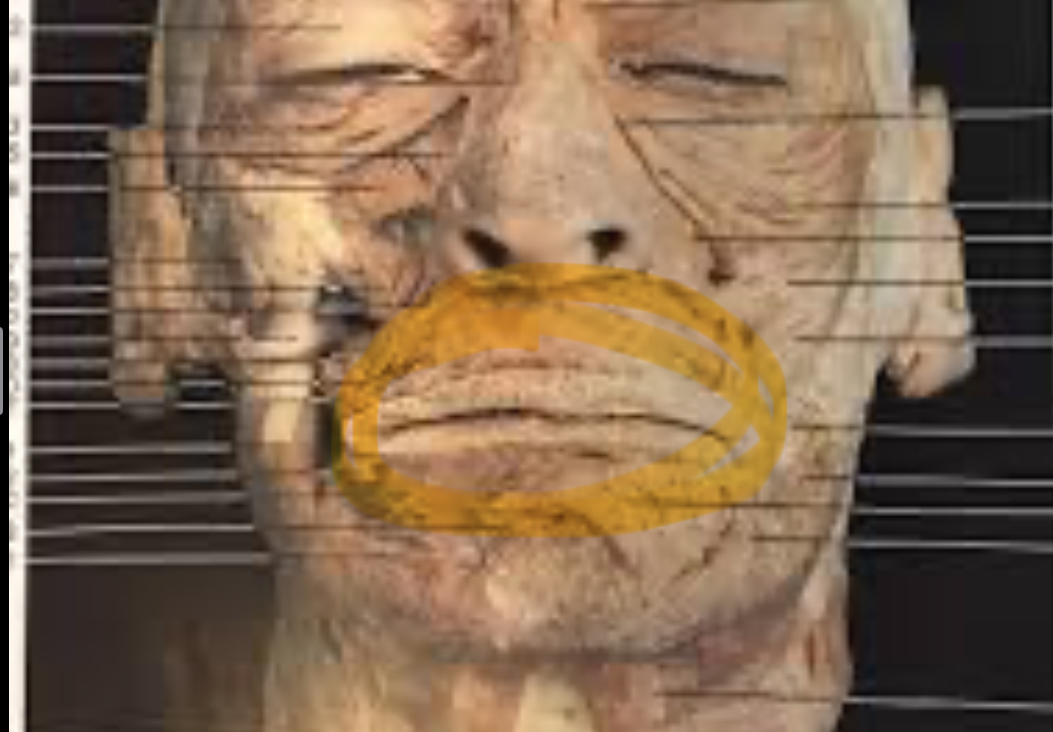 <p>Orbicularis oris </p>