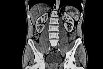 <p>CT - used to see soft tissues</p>
