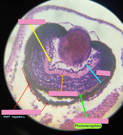 <p>what level (lateral side)<br>primary brain vesicle<br>parts</p>