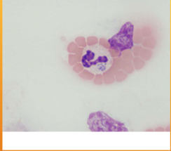 <p><span style="color: rgb(254, 254, 254);"><span>Anaplasma spp.; A. phagocytophilum/A. platys</span></span><span style="color: rgb(254, 254, 254);"><br></span><span style="color: rgb(254, 254, 254);"><span>(formerly Ehrlichia platys)</span></span></p>