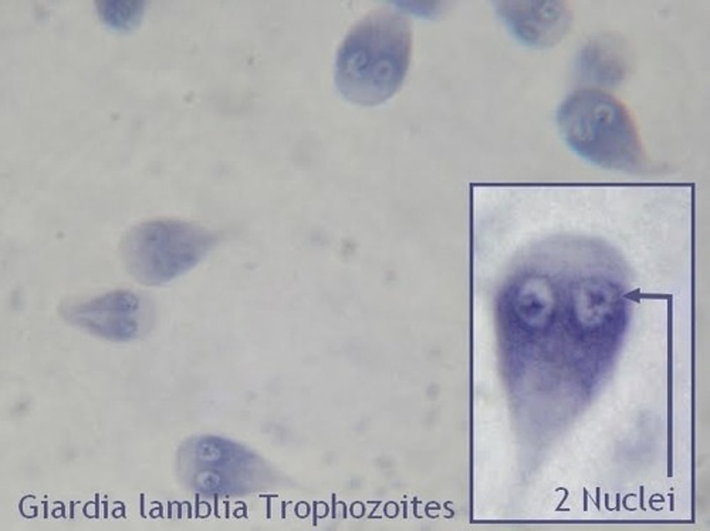 <p>water-borne protozoa that infects the small intestines. it has 2 life stages: cyst (egg) and trophozoite (motile feeding form. (THE CYST FORM IS INGESTED AND DEVELOPS INTO THE TROPHOZOITE IN THE SMALL INTESTINE) This is commonly found in cats, dogs, humans, and beavers (beaver fever) It is also found most common in young dogs or cats in a shelter setting.</p>