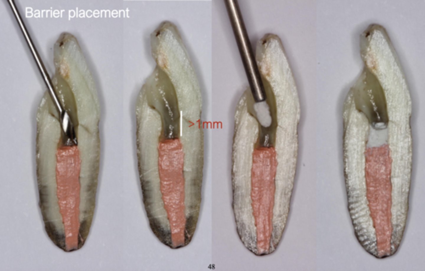 <p>>1mm</p>