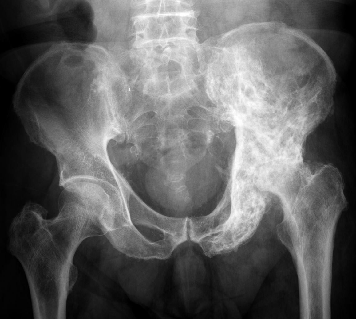 <p>Identify the pathology</p>