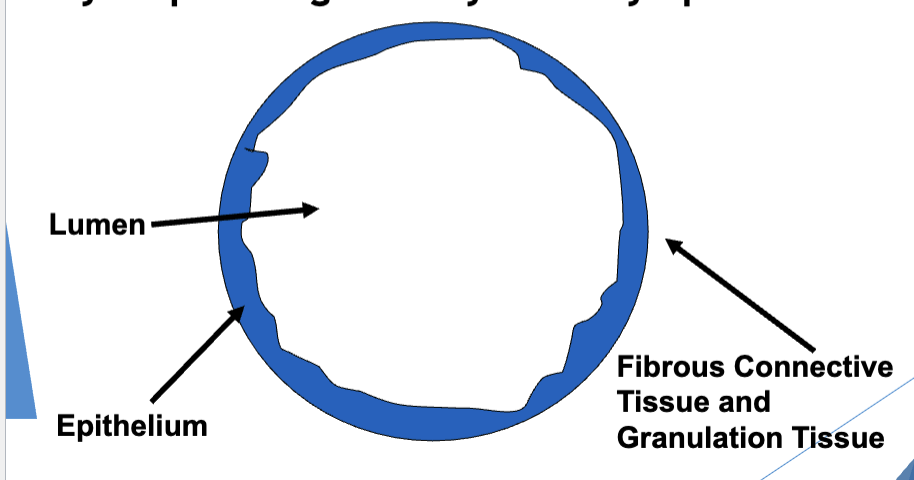 <p>outer → inner</p><ol><li><p>fibrous CT + granulation tissue </p></li><li><p>epithelium </p></li><li><p>lumen </p></li></ol><p></p>