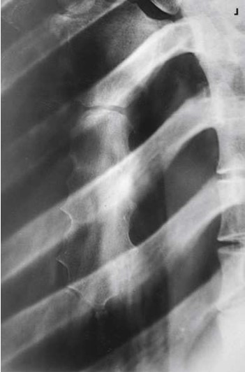 <p>What projection, position and anatomy is this?</p>