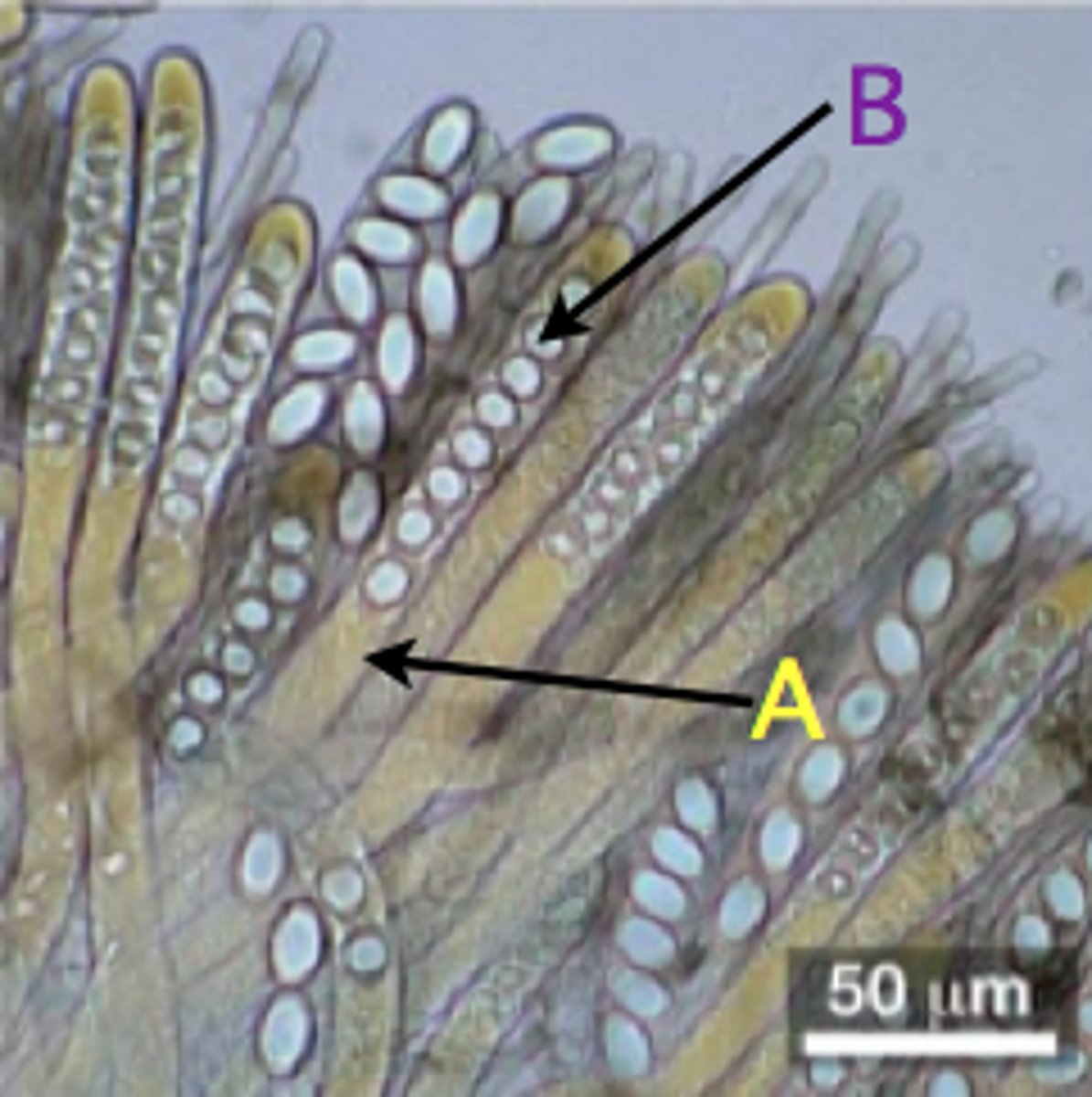 <p>A; <span>sac-shaped cells/sporangium containing ascospores - haploid sexual spores produced by meiosis; terminal hyphae</span></p>