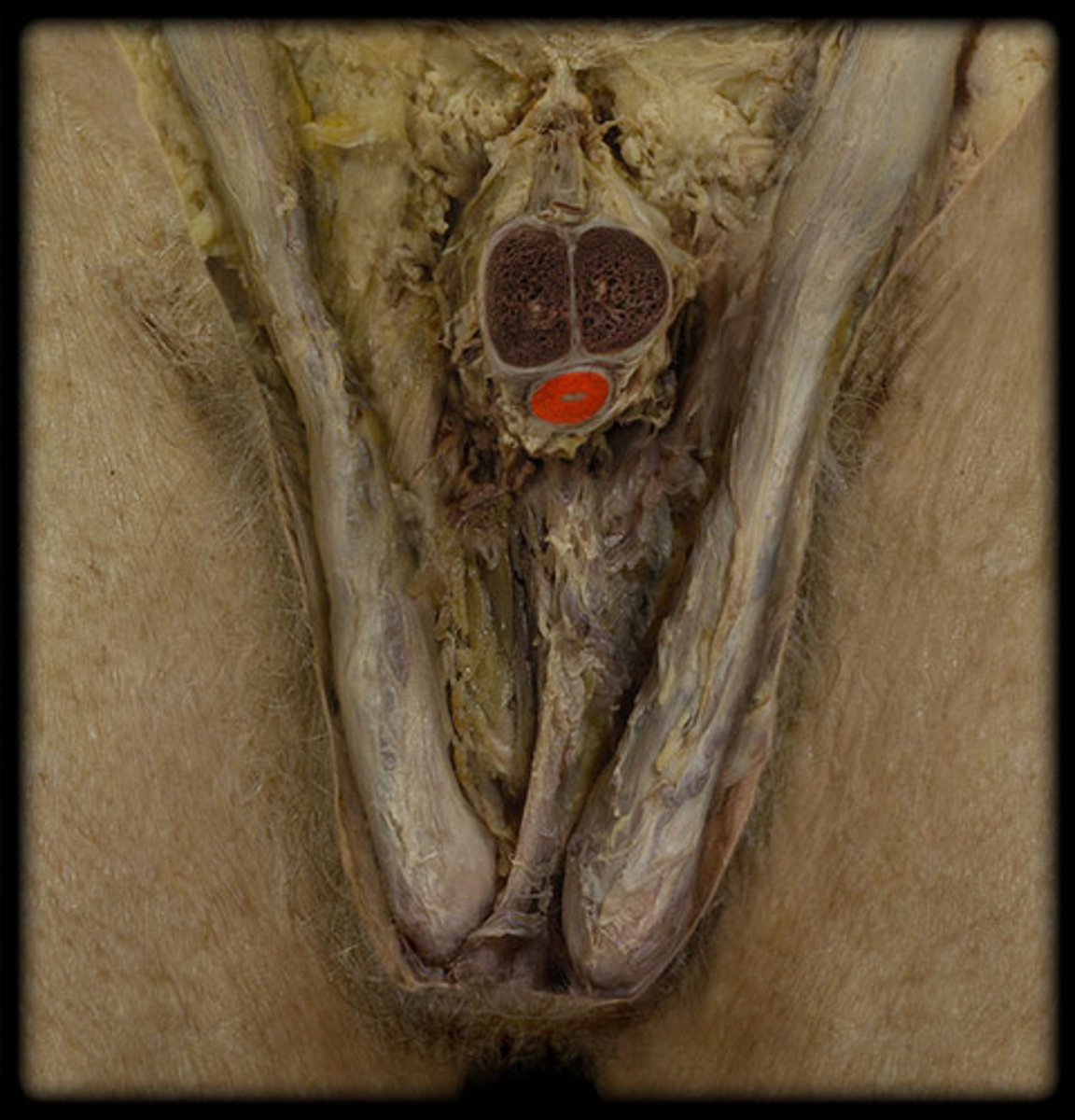 <p>single spongy tissue surrounding the male urethra within the penis</p>