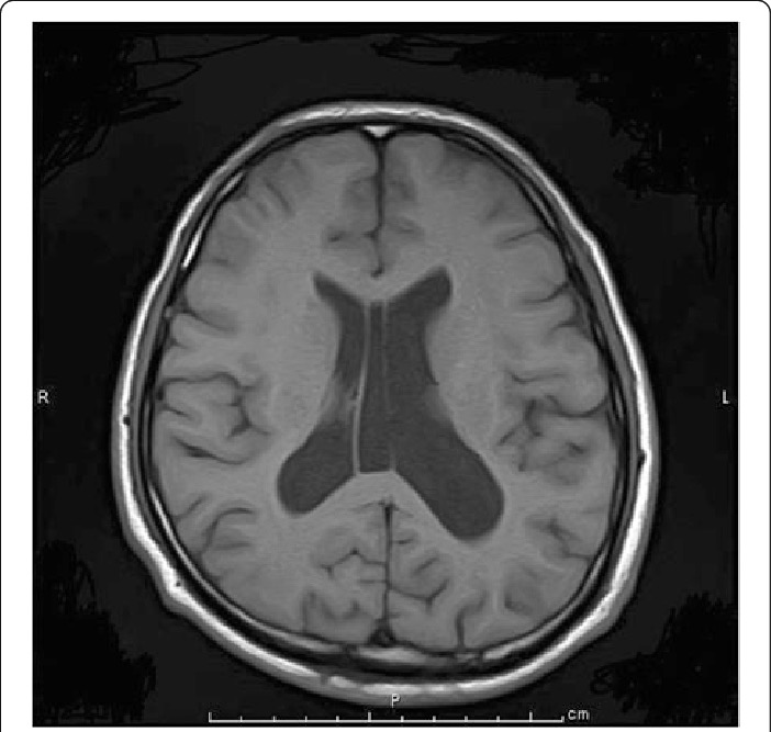 <p>Galen: examines solders from the roman army. Is clear to him that the brain is the center of behavior. Brain acts like a heart: beats and pumps out fluid in ventricles and pushes into arms and legs to make then move </p>