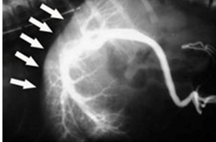 <p>what does the radiograph show?</p>