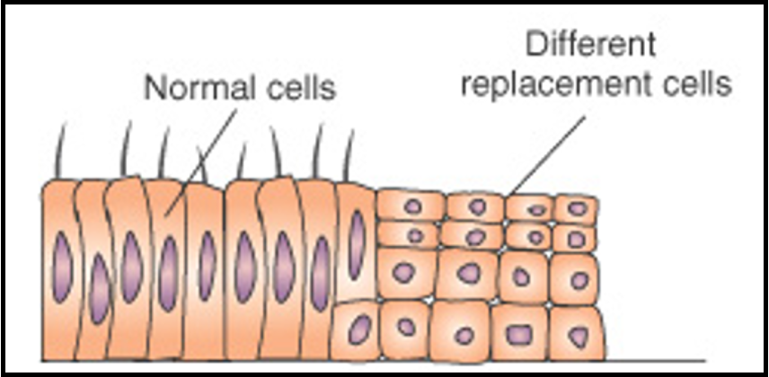 <p>outline metaplasia</p>