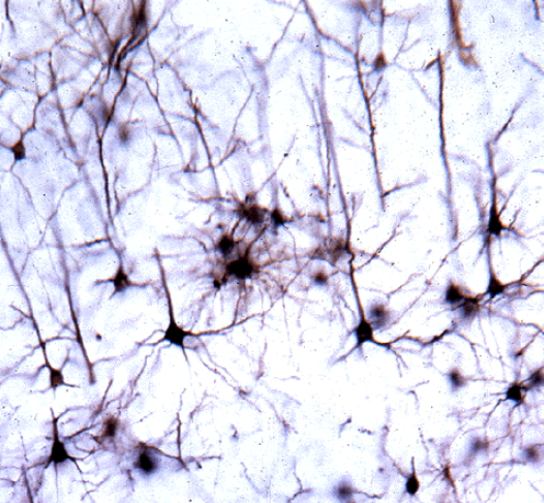 <p>pyramidal cell, motor cortex</p>
