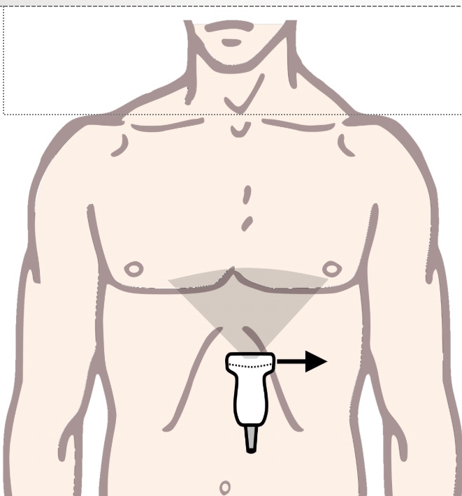 <p>What echo view will this give you?</p>