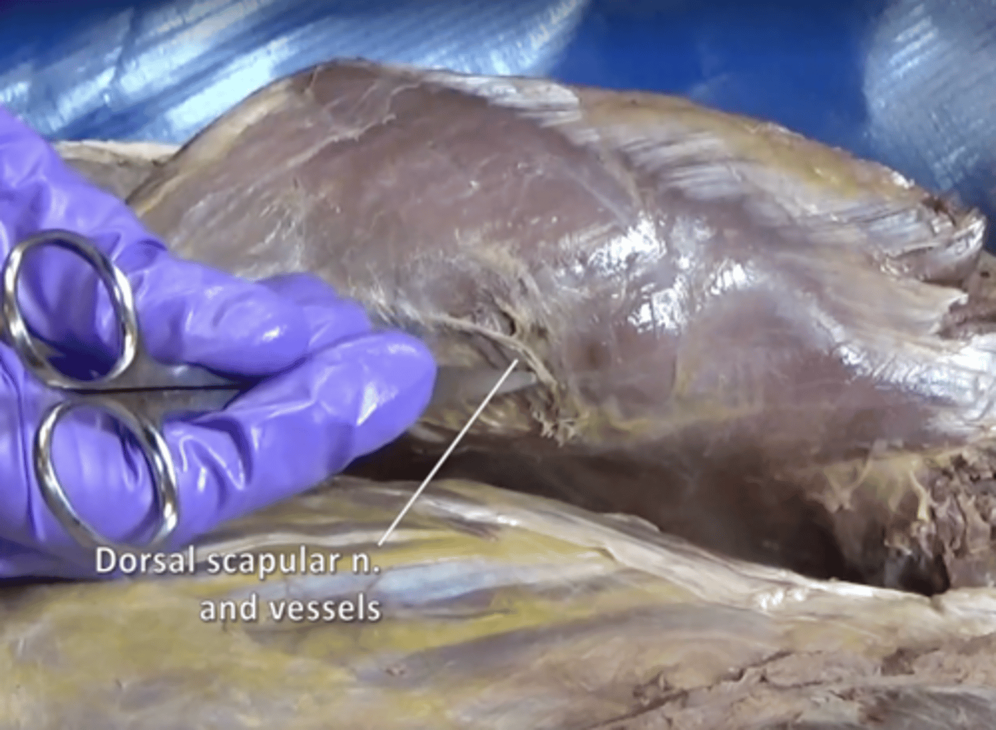 <p>Innervates rhomboids and levator scapulae.</p>