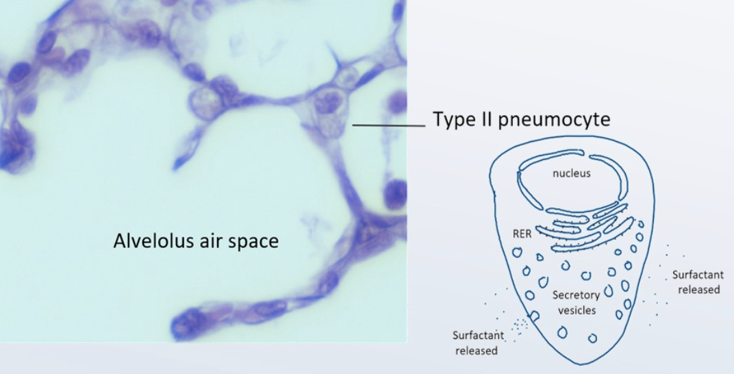 <p>many secretory vesicles (lamellar bodies) in their cytoplasm, make and release surfactant to alveolar lumen</p>