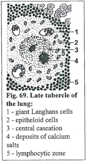 <p><strong>Pneumonia tuberculosa miliaris– poultry</strong></p><img src="https://knowt-user-attachments.s3.amazonaws.com/1bbd5fe4-be3d-498d-87bb-2ec9ee1d0cf3.png" data-width="50%" data-align="center"><p></p>