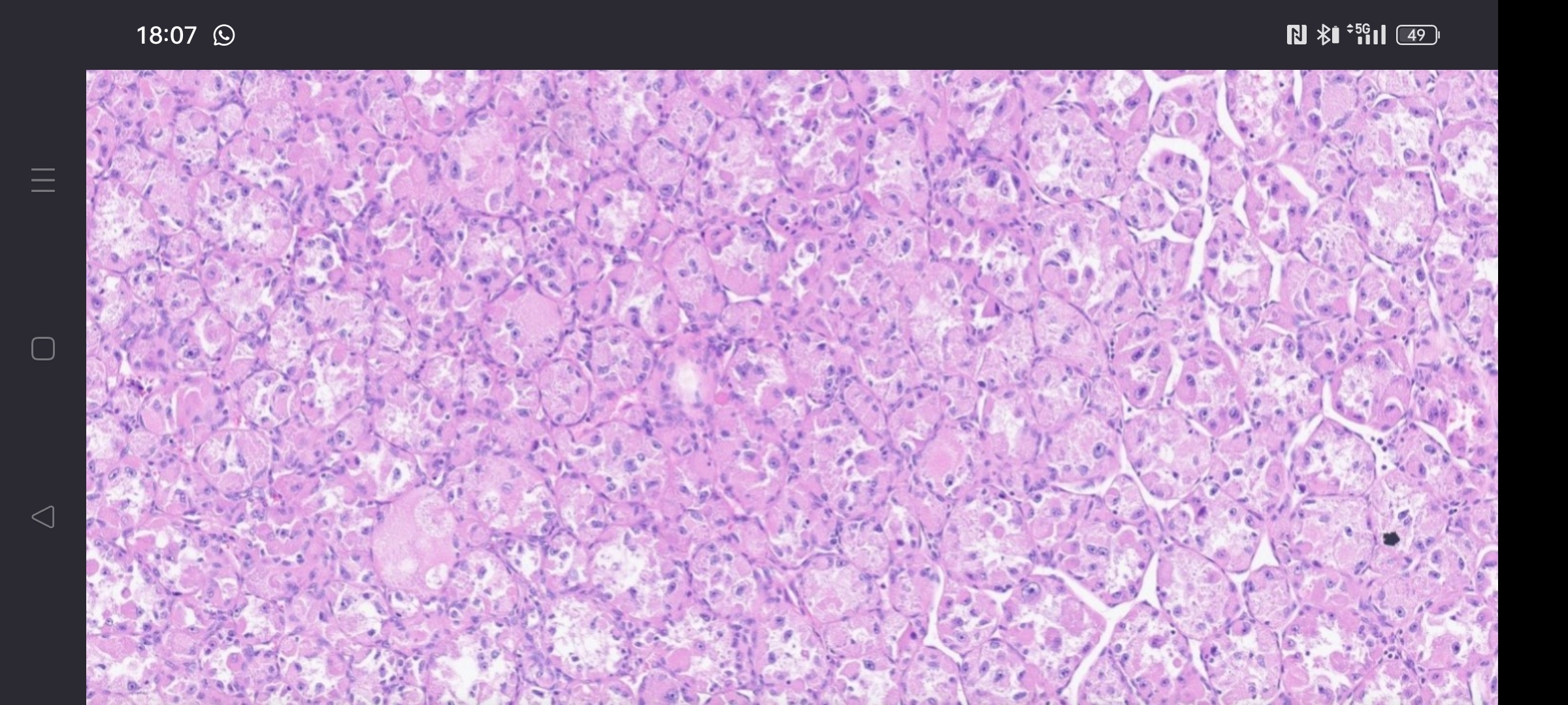<p>1)Diagnostic</p><p>2) histology </p><p>3) molecular</p><p>4) dd</p>