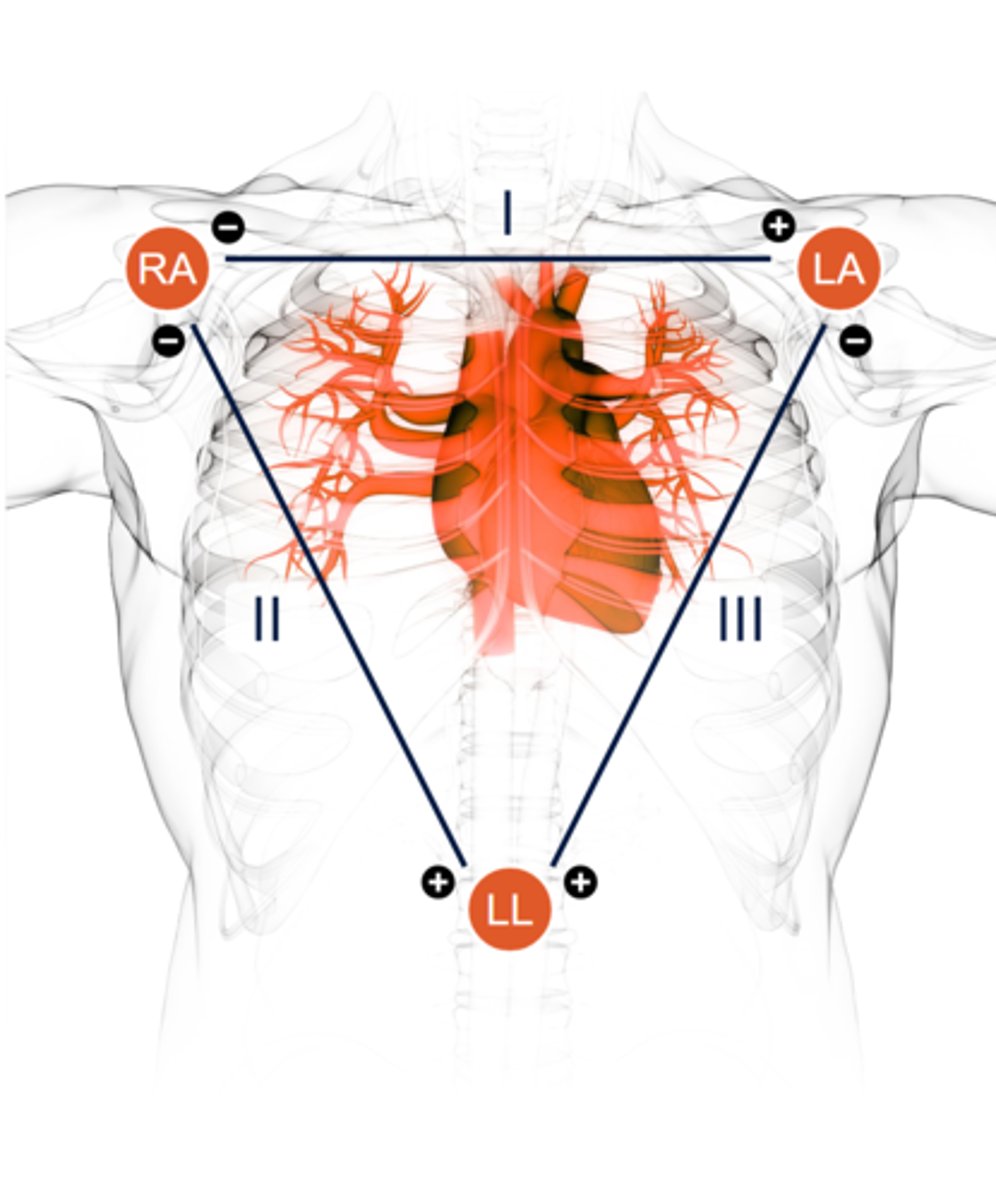 <p>Based on triangle formed with LA, RA, LL 9red, black, and white)</p><p>Triangle is the basis for limb lead tracings (I, II, III, aVR, aVL, and aVF)</p><p>Each lead tracing is bipolar, one positive and one negative</p><p>Shows frontal plane of cardiac conduction</p>
