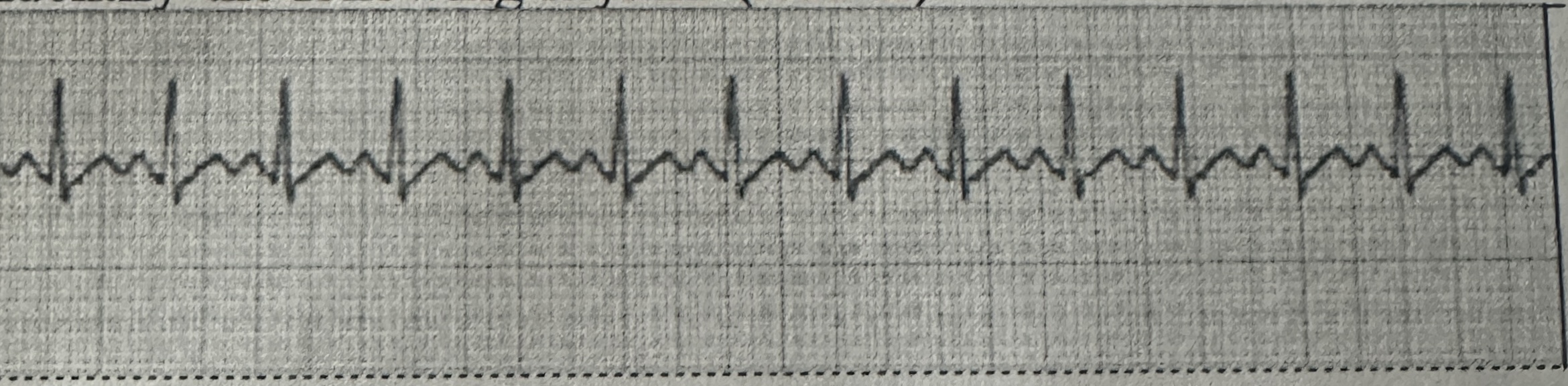<p>identify this rhythm</p>