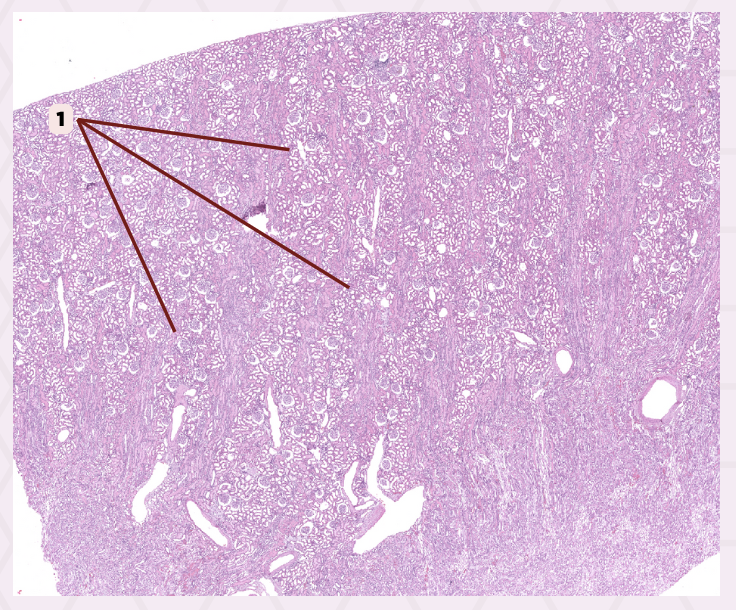 <p>#1 has a double-walled sac component that envelops the glomerulus. What do you call this structure?</p>