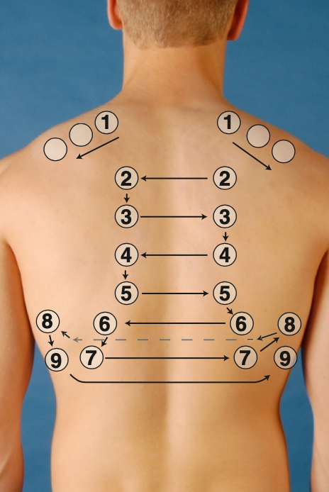 <ul><li><p>Start at the apices, percussing side to side in interspaces, moving downwards</p></li><li><p>Avoid percussion over the scapulae and ribs.</p></li></ul><p></p>
