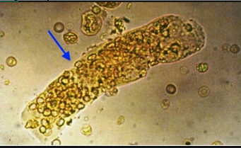 <p>What type of cast is shown in the illustration?</p>