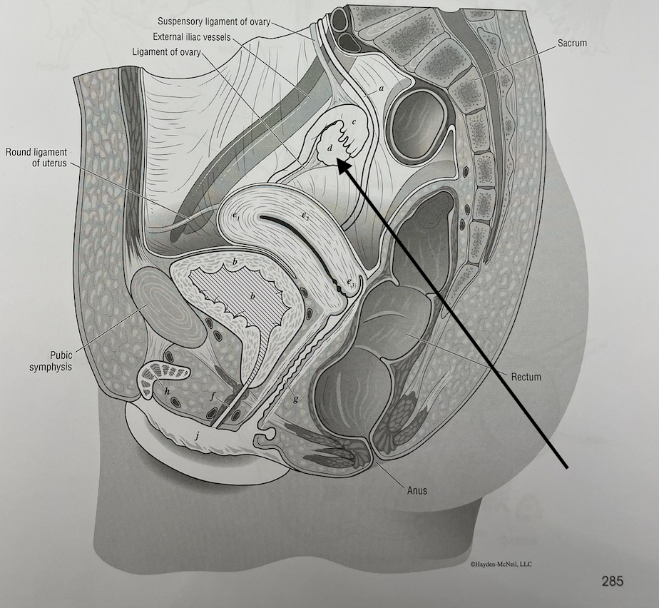 <p>what structure is this</p>