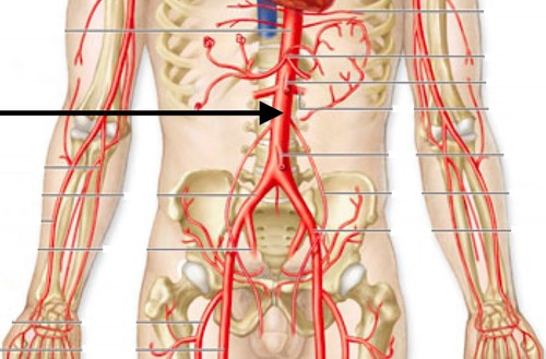 <p>Carries oxygenated blood away from the heart; largest artery in the body</p>