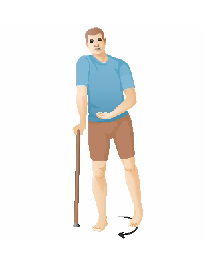 Was ist eine Plegie/ Paralyse? (Erklärung und Krankheitsbilder) 