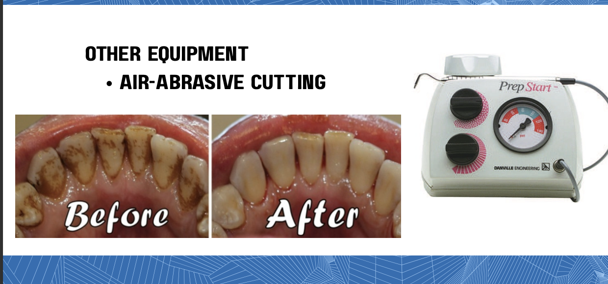 <ul><li><p><span style="color: red;"><strong>Not generally accepted for tooth preparation</strong></span></p></li><li><p>Only helpful for stain removal, debriding pits and fissures before sealing, and micromechanical roughening of surfaces to be bonded.</p></li></ul><p></p>