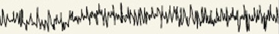 <p>Which category of brain wave is:</p><ul><li><p>Adults concentrating</p></li></ul><p></p>