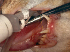 <p><span>Small Intestinal Foreign Body</span></p>