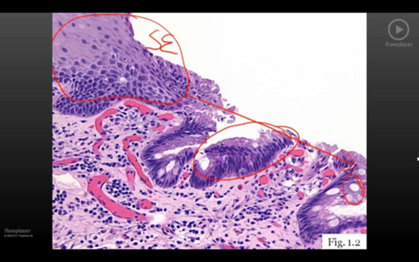 <p>Id Dz (pathophys)</p>