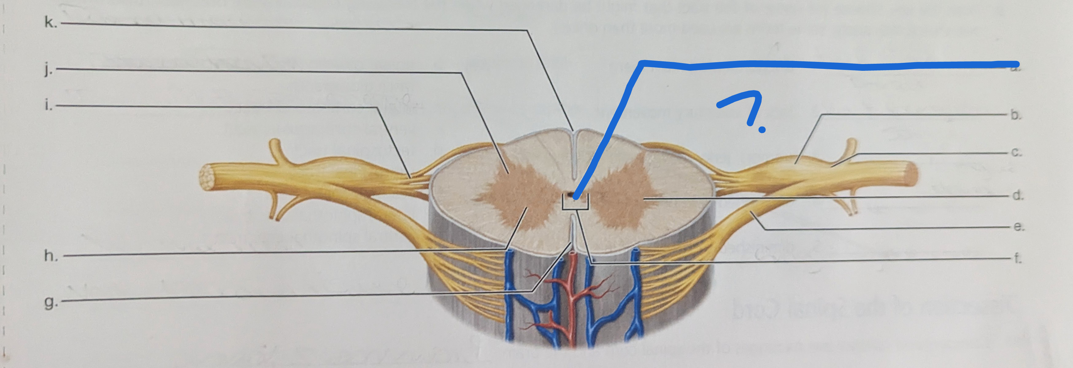 <p>What is the name of this?</p>